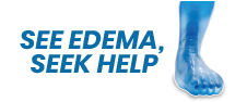 Edemaawareness